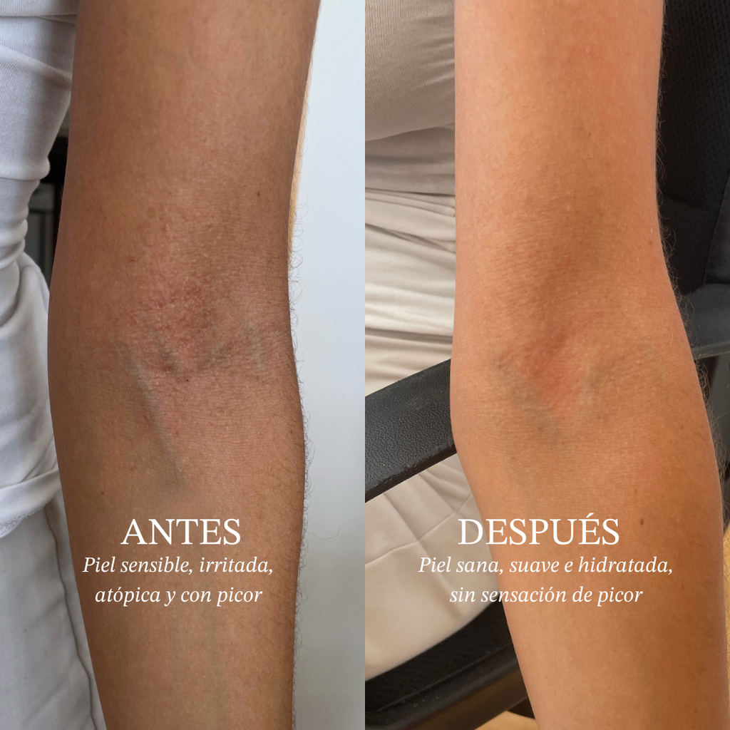Gel de cuerpo suavizante